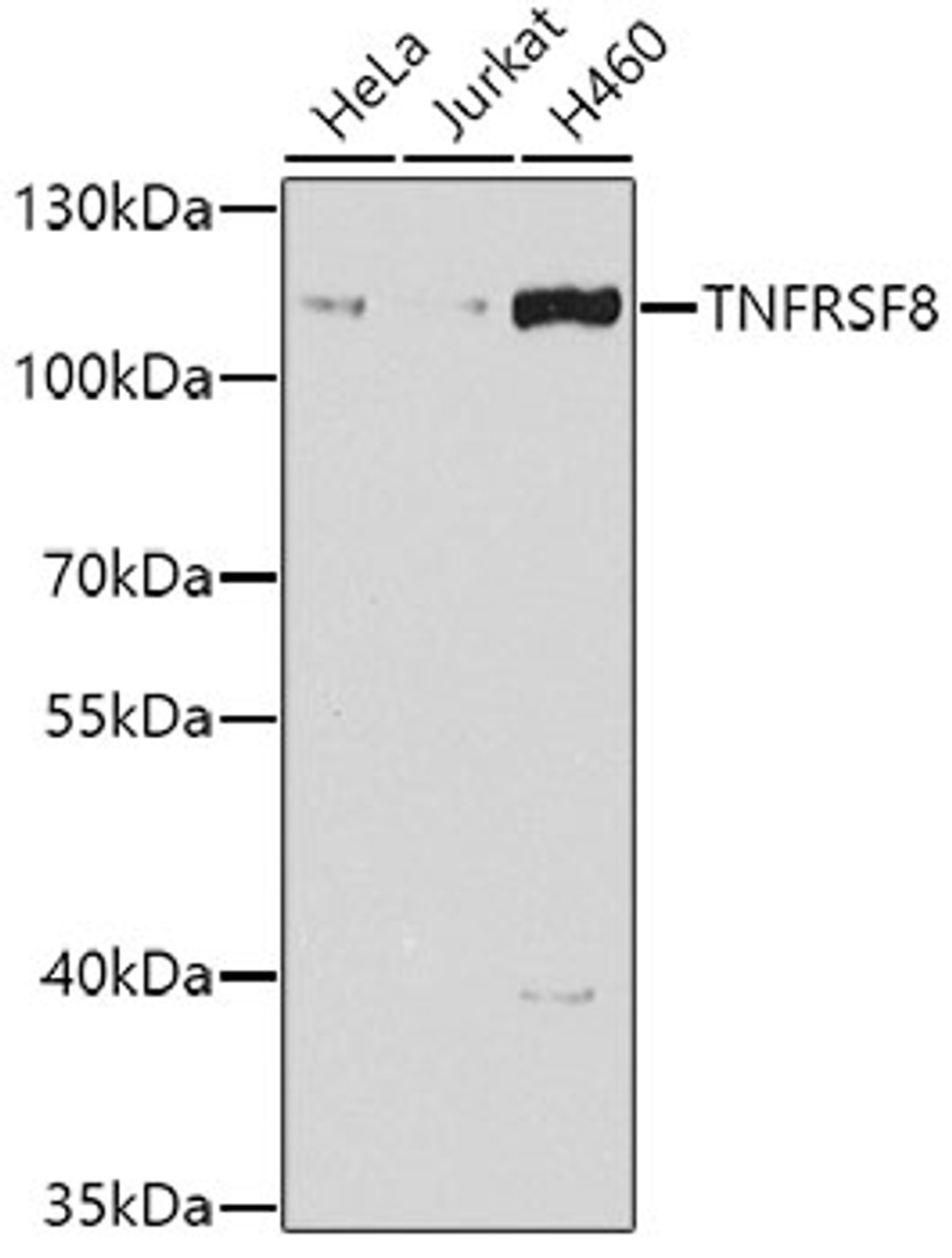Western blot analysis of extracts of various cell lines, using TNFRSF8 antibody (23-081) at 1:1000 dilution.<br/>Secondary antibody: HRP Goat Anti-Rabbit IgG (H+L) at 1:10000 dilution.<br/>Lysates/proteins: 25ug per lane.<br/>Blocking buffer: 3% nonfat dry milk in TBST.<br/>Detection: ECL Basic Kit.<br/>Exposure time: 30s.