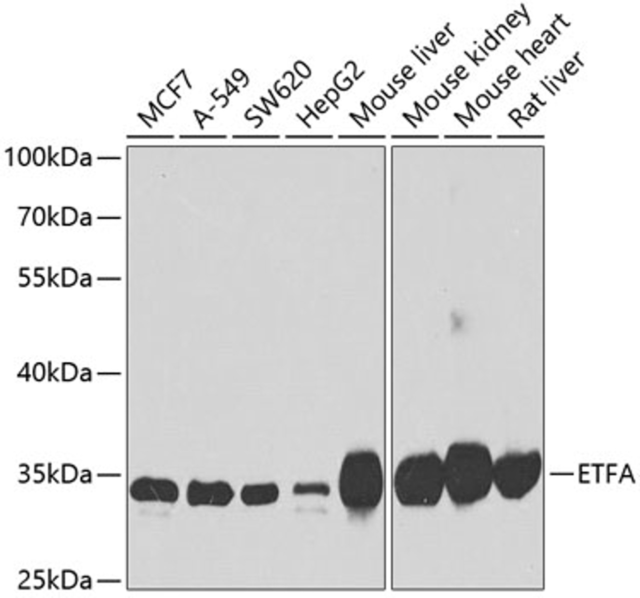 Western blot analysis of extracts of various cell lines, using ETFA antibody (23-094) at 1:1000 dilution.<br/>Secondary antibody: HRP Goat Anti-Rabbit IgG (H+L) at 1:10000 dilution.<br/>Lysates/proteins: 25ug per lane.<br/>Blocking buffer: 3% nonfat dry milk in TBST.<br/>Detection: ECL Basic Kit.<br/>Exposure time: 90s.