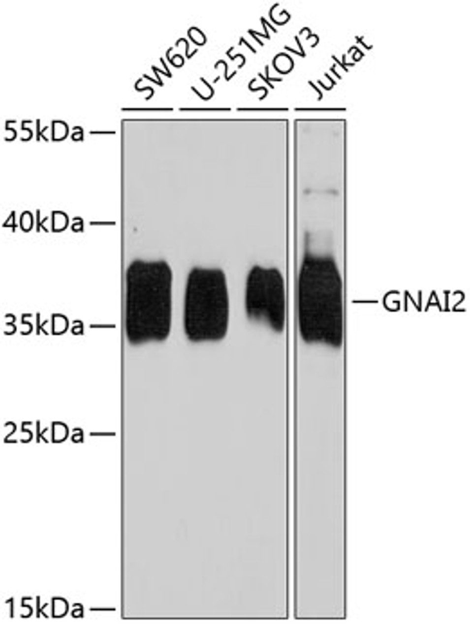 Western blot analysis of extracts of various cell lines, using GNAI2 antibody (23-098) at 1:1000 dilution._Secondary antibody: HRP Goat Anti-Rabbit IgG (H+L) at 1:10000 dilution._Lysates/proteins: 25ug per lane._Blocking buffer: 3% nonfat dry milk in TBST._Detection: ECL Enhanced Kit._Exposure time: 5s.