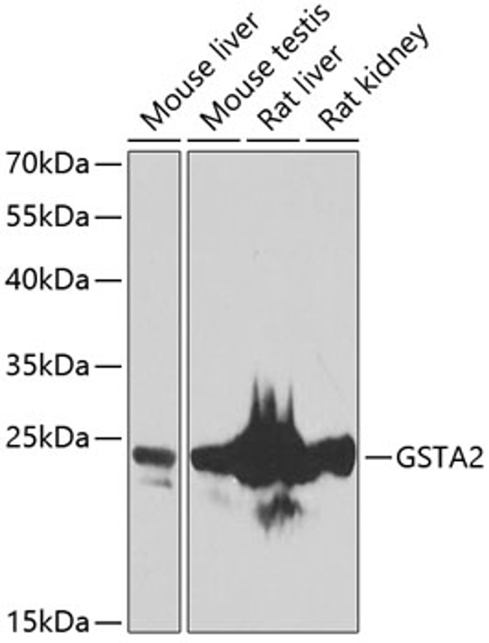 Western blot analysis of extracts of various cell lines, using GSTA2 antibody (23-102) at 1:1000 dilution.<br/>Secondary antibody: HRP Goat Anti-Rabbit IgG (H+L) at 1:10000 dilution.<br/>Lysates/proteins: 25ug per lane.<br/>Blocking buffer: 3% nonfat dry milk in TBST.<br/>Detection: ECL Basic Kit.<br/>Exposure time: 90s.
