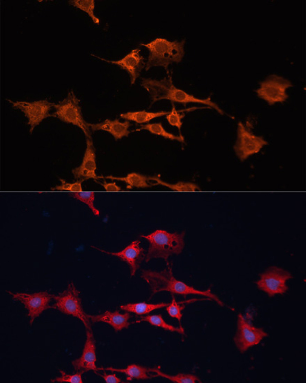 Immunofluorescence analysis of C6 cells using GSTM3 antibody (23-103) at dilution of 1:100. Blue: DAPI for nuclear staining.