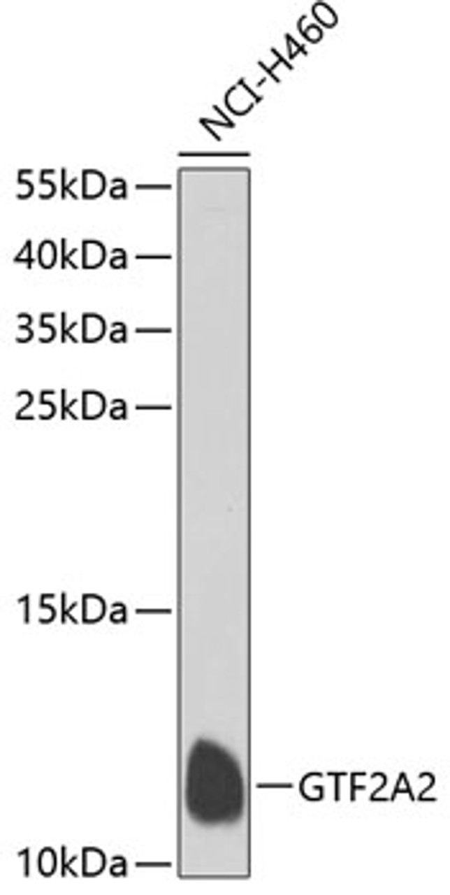 Western blot analysis of extracts of NCI-H460 cells, using GTF2A2 antibody (23-104) at 1:1000 dilution.<br/>Secondary antibody: HRP Goat Anti-Rabbit IgG (H+L) at 1:10000 dilution.<br/>Lysates/proteins: 25ug per lane.<br/>Blocking buffer: 3% nonfat dry milk in TBST.<br/>Detection: ECL Basic Kit.<br/>Exposure time: 90s.