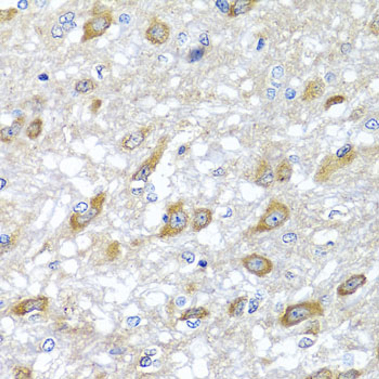 Immunohistochemistry of paraffin-embedded rat brain using HSPA6 antibody (23-108) at dilution of 1:100 (40x lens) .