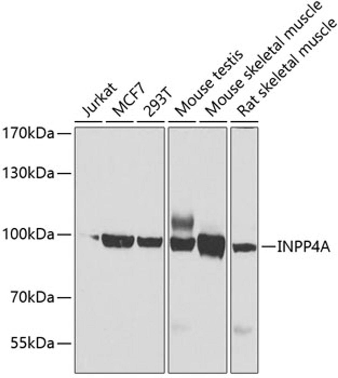 Western blot analysis of extracts of various cell lines, using INPP4A antibody (23-111) at 1:1000 dilution.<br/>Secondary antibody: HRP Goat Anti-Rabbit IgG (H+L) at 1:10000 dilution.<br/>Lysates/proteins: 25ug per lane.<br/>Blocking buffer: 3% nonfat dry milk in TBST.<br/>Detection: ECL Basic Kit.<br/>Exposure time: 30s.