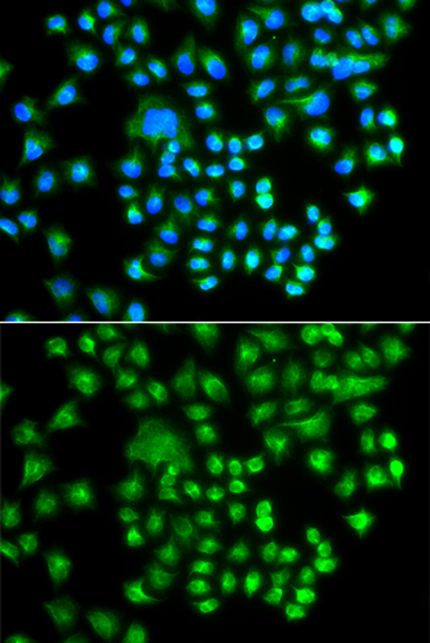 Immunofluorescence analysis of A549 cells using PRKACG antibody (23-124) . Blue: DAPI for nuclear staining.