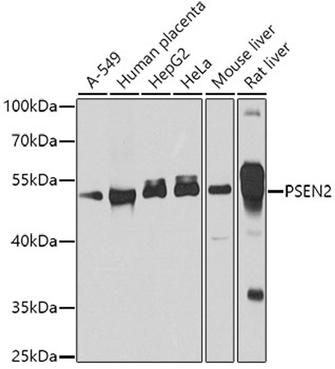 Western blot analysis of extracts of various cell lines, using PSEN2 antibody (23-128) at 1:1000 dilution.<br/>Secondary antibody: HRP Goat Anti-Rabbit IgG (H+L) at 1:10000 dilution.<br/>Lysates/proteins: 25ug per lane.<br/>Blocking buffer: 3% nonfat dry milk in TBST.<br/>Detection: ECL Basic Kit.<br/>Exposure time: 15s.