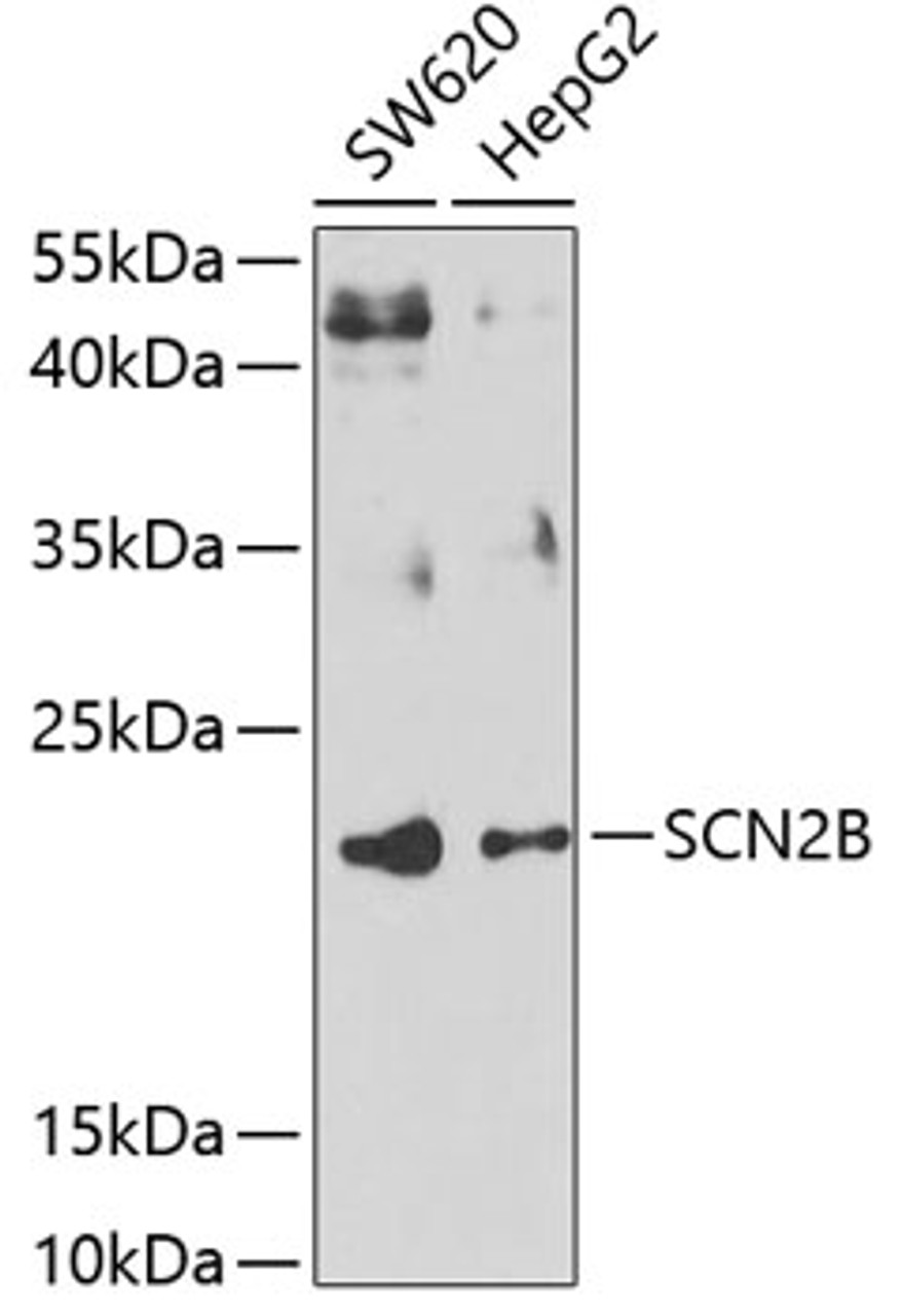 Western blot analysis of extracts of various cell lines, using SCN2B antibody (23-131) at 1:1000 dilution.<br/>Secondary antibody: HRP Goat Anti-Rabbit IgG (H+L) at 1:10000 dilution.<br/>Lysates/proteins: 25ug per lane.<br/>Blocking buffer: 3% nonfat dry milk in TBST.<br/>Detection: ECL Basic Kit.<br/>Exposure time: 30s.