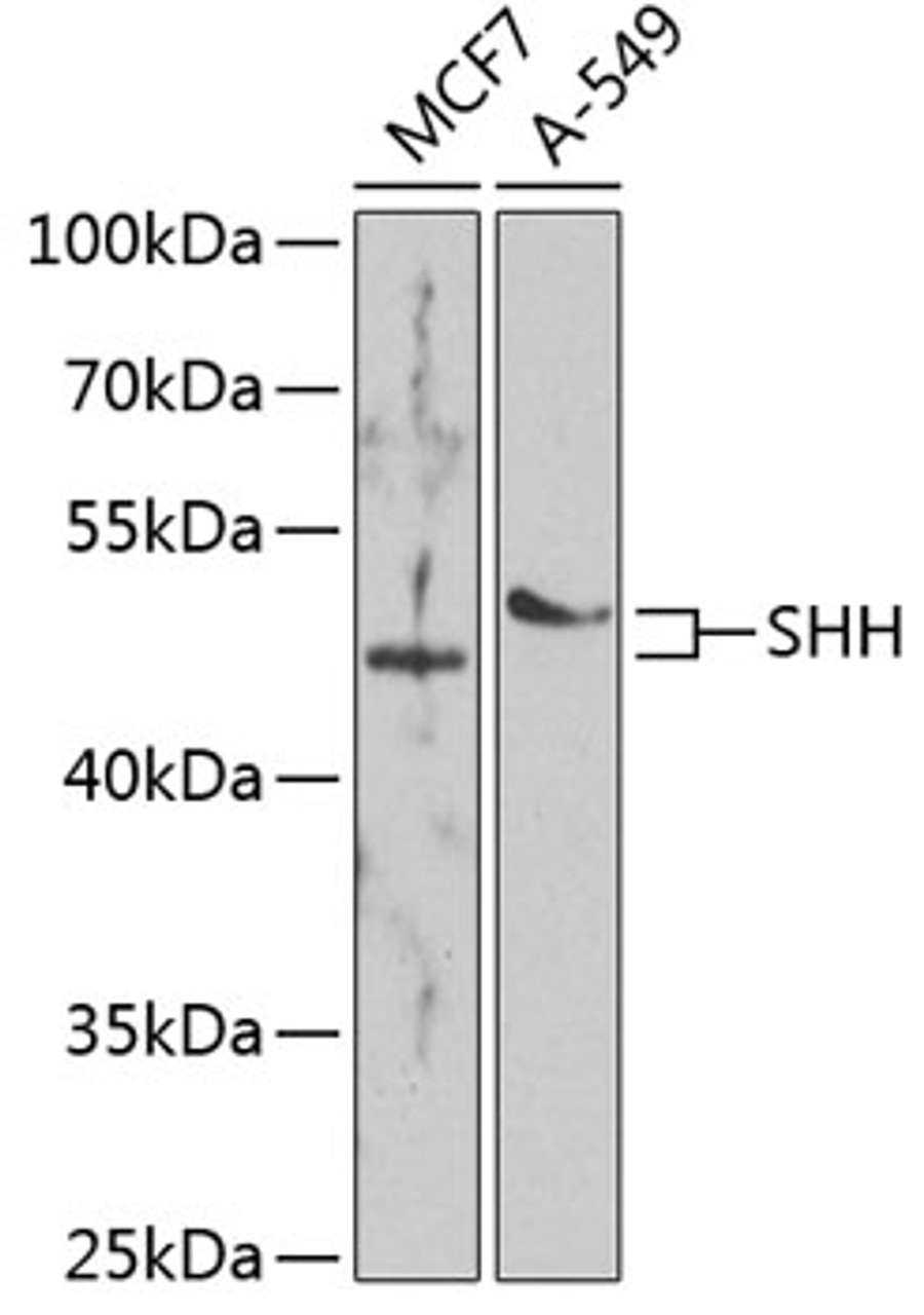 Western blot analysis of extracts of various cell lines, using SHH antibody (23-134) at 1:1000 dilution._Secondary antibody: HRP Goat Anti-Rabbit IgG (H+L) at 1:10000 dilution._Lysates/proteins: 25ug per lane._Blocking buffer: 3% nonfat dry milk in TBST._Detection: ECL Enhanced Kit._Exposure time: 60s.