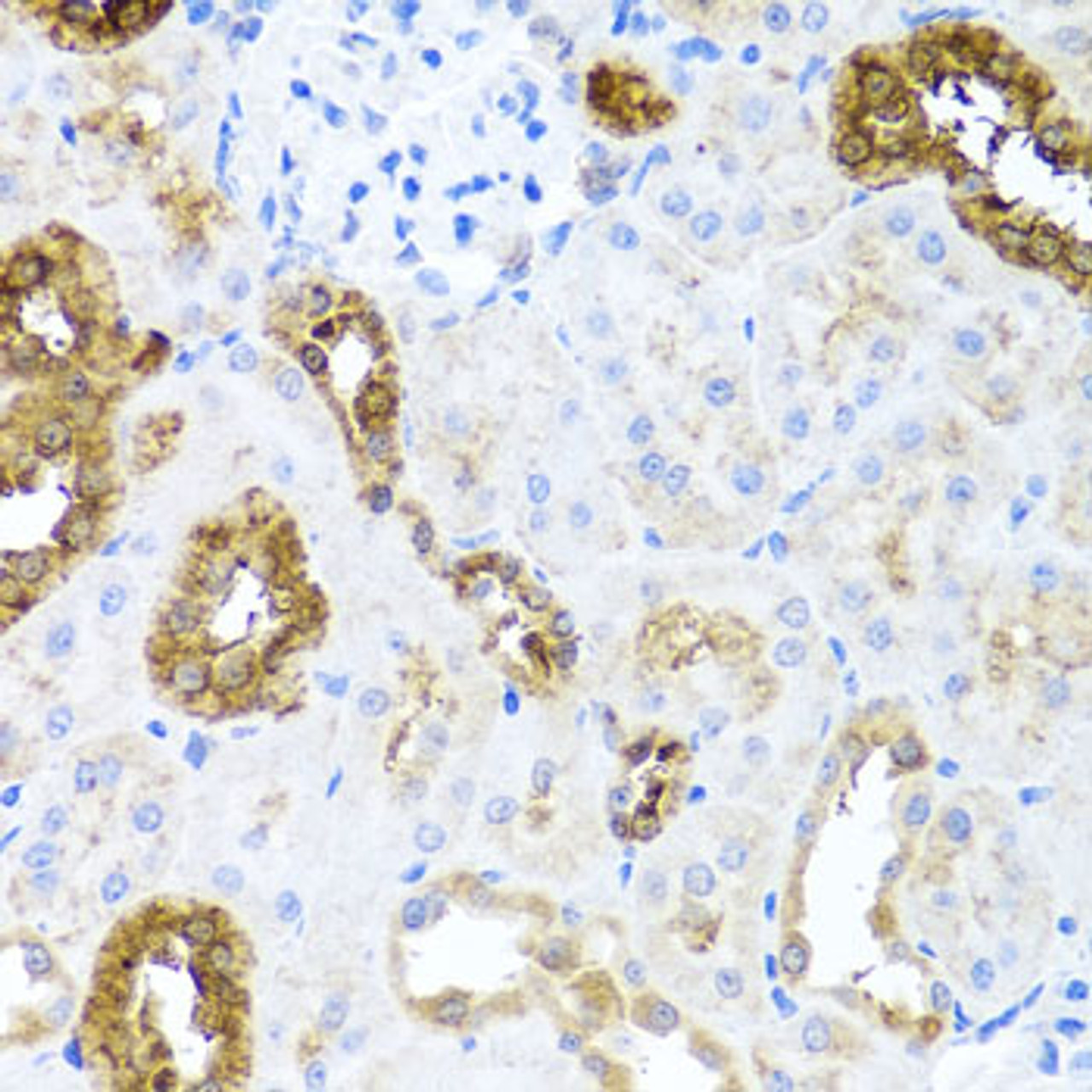 Immunohistochemistry of paraffin-embedded rat kidney using SHH antibody (23-134) at dilution of 1:100 (40x lens) .
