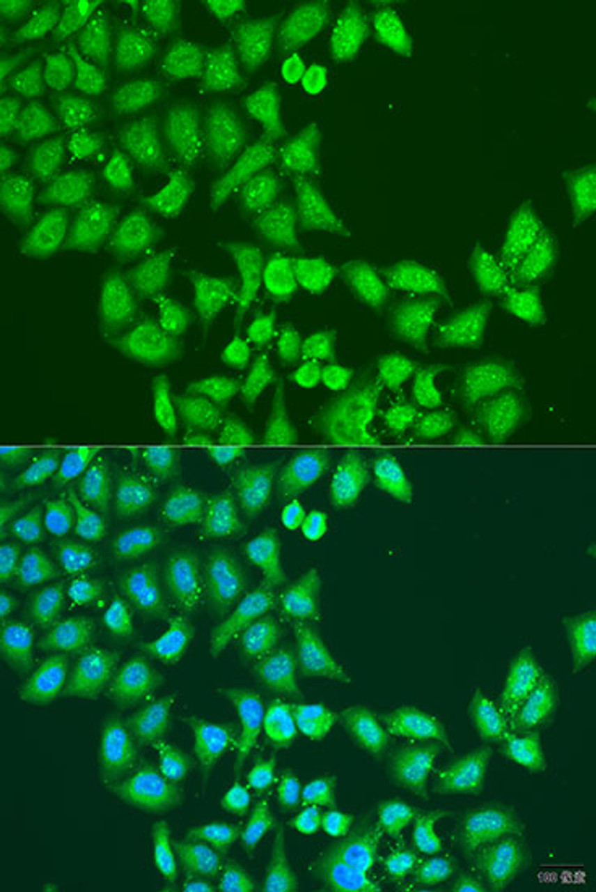 Immunofluorescence analysis of U2OS cells using STAT5A antibody (23-141) at dilution of 1:100. Blue: DAPI for nuclear staining.