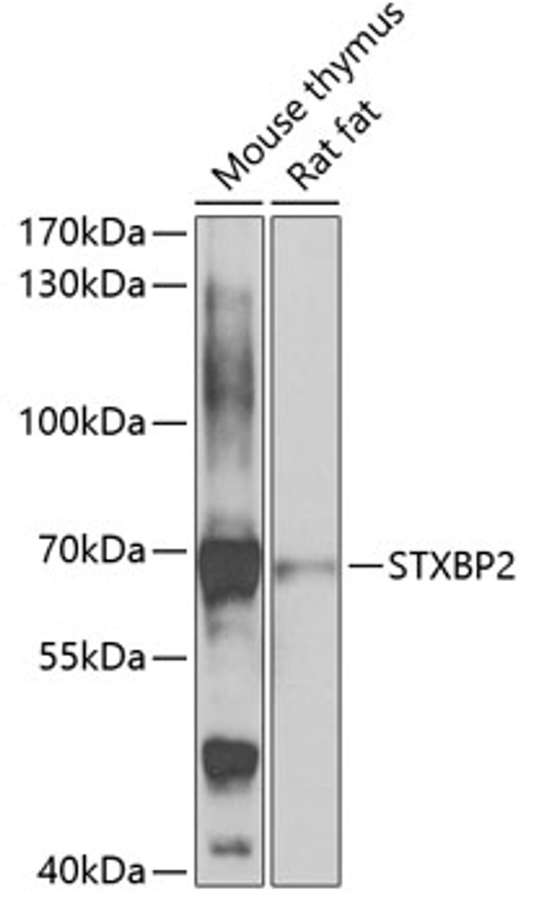 Western blot analysis of extracts of various cell lines, using STXBP2 antibody (23-143) at 1:1000 dilution.<br/>Secondary antibody: HRP Goat Anti-Rabbit IgG (H+L) at 1:10000 dilution.<br/>Lysates/proteins: 25ug per lane.<br/>Blocking buffer: 3% nonfat dry milk in TBST.<br/>Detection: ECL Basic Kit.<br/>Exposure time: 30s.