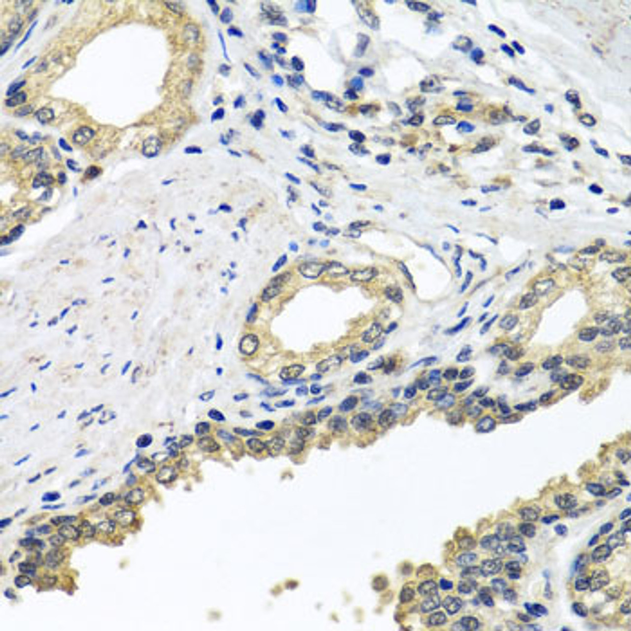 Immunohistochemistry of paraffin-embedded human prostate using STXBP2 antibody (23-143) at dilution of 1:100 (40x lens) .