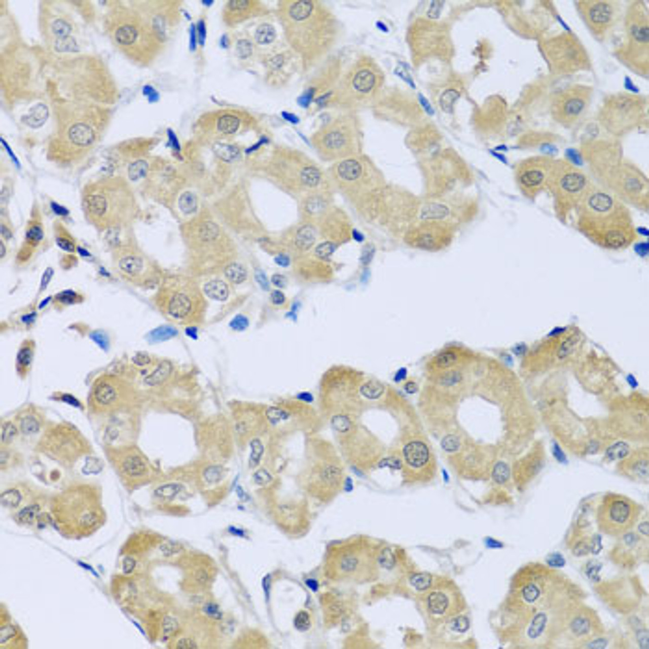 Immunohistochemistry of paraffin-embedded human stomach using SYT4 antibody (23-145) at dilution of 1:100 (40x lens) .