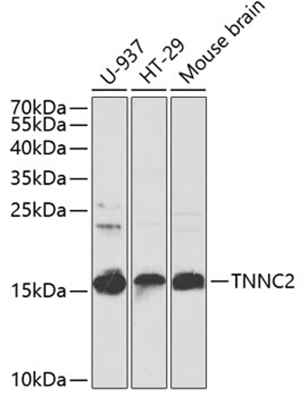Western blot analysis of extracts of various cell lines, using TNNC2 antibody (23-146) at 1:1000 dilution._Secondary antibody: HRP Goat Anti-Rabbit IgG (H+L) at 1:10000 dilution._Lysates/proteins: 25ug per lane._Blocking buffer: 3% nonfat dry milk in TBST._Detection: ECL Enhanced Kit._Exposure time: 15s.