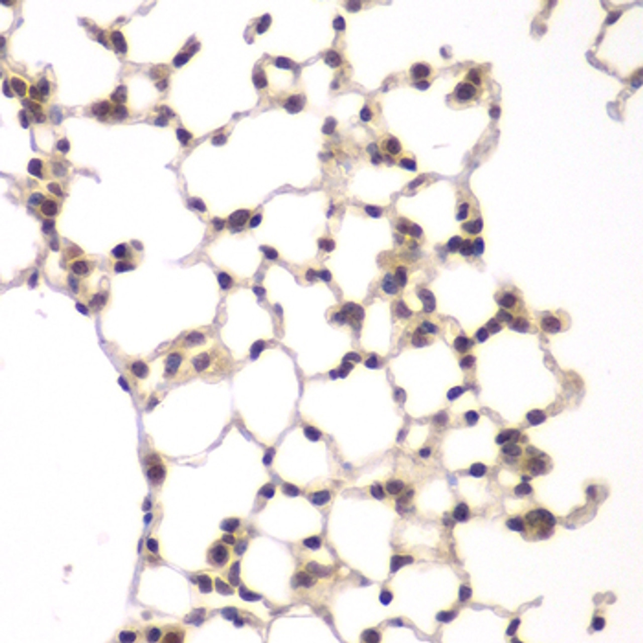 Immunohistochemistry of paraffin-embedded rat lung using VRK1 antibody (23-150) at dilution of 1:100 (40x lens) .