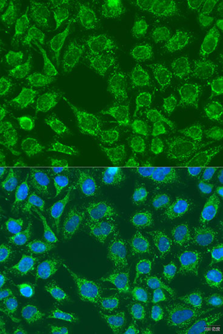 Immunofluorescence analysis of U2OS cells using WNT7B antibody (23-151) at dilution of 1:100. Blue: DAPI for nuclear staining.