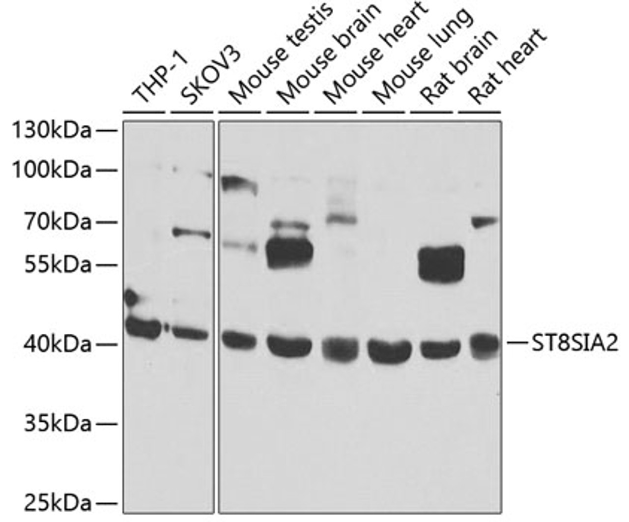 Western blot analysis of extracts of various cell lines, using ST8SIA2 antibody (23-153) at 1:1000 dilution.<br/>Secondary antibody: HRP Goat Anti-Rabbit IgG (H+L) at 1:10000 dilution.<br/>Lysates/proteins: 25ug per lane.<br/>Blocking buffer: 3% nonfat dry milk in TBST.<br/>Detection: ECL Basic Kit.<br/>Exposure time: 30s.