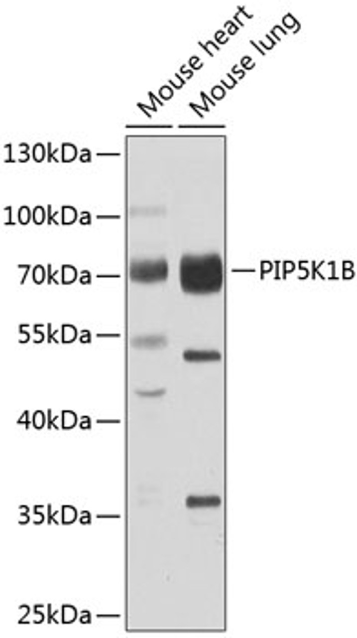 Western blot analysis of extracts of various cell lines, using PIP5K1B antibody (23-154) at 1:1000 dilution.<br/>Secondary antibody: HRP Goat Anti-Rabbit IgG (H+L) at 1:10000 dilution.<br/>Lysates/proteins: 25ug per lane.<br/>Blocking buffer: 3% nonfat dry milk in TBST.<br/>Detection: ECL Basic Kit.<br/>Exposure time: 10s.