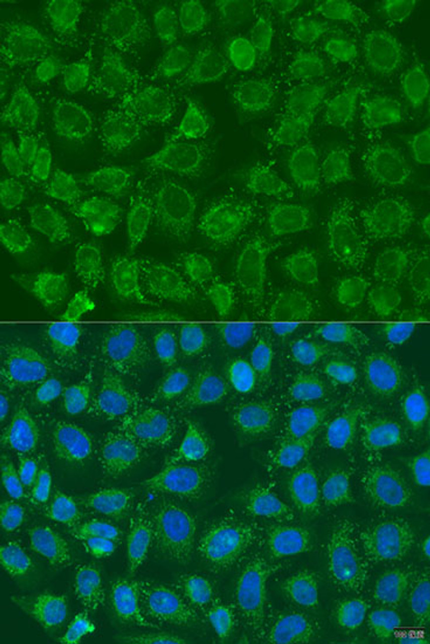 Immunofluorescence analysis of U2OS cells using PIP5K1B antibody (23-154) at dilution of 1:100. Blue: DAPI for nuclear staining.