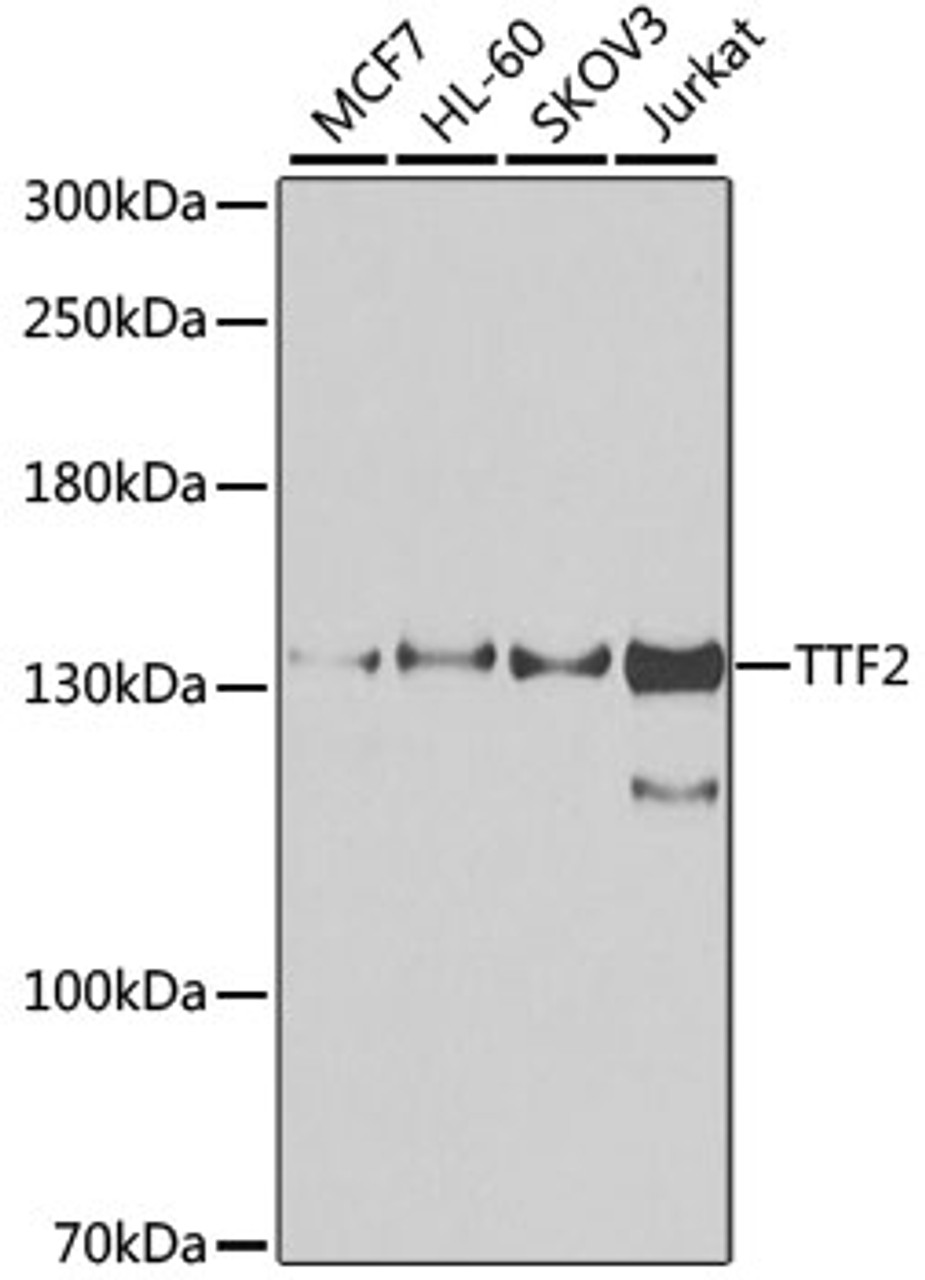 Western blot analysis of extracts of various cell lines, using TTF2 antibody (23-156) at 1:1000 dilution.<br/>Secondary antibody: HRP Goat Anti-Rabbit IgG (H+L) at 1:10000 dilution.<br/>Lysates/proteins: 25ug per lane.<br/>Blocking buffer: 3% nonfat dry milk in TBST.<br/>Detection: ECL Enhanced Kit.<br/>Exposure time: 30s.