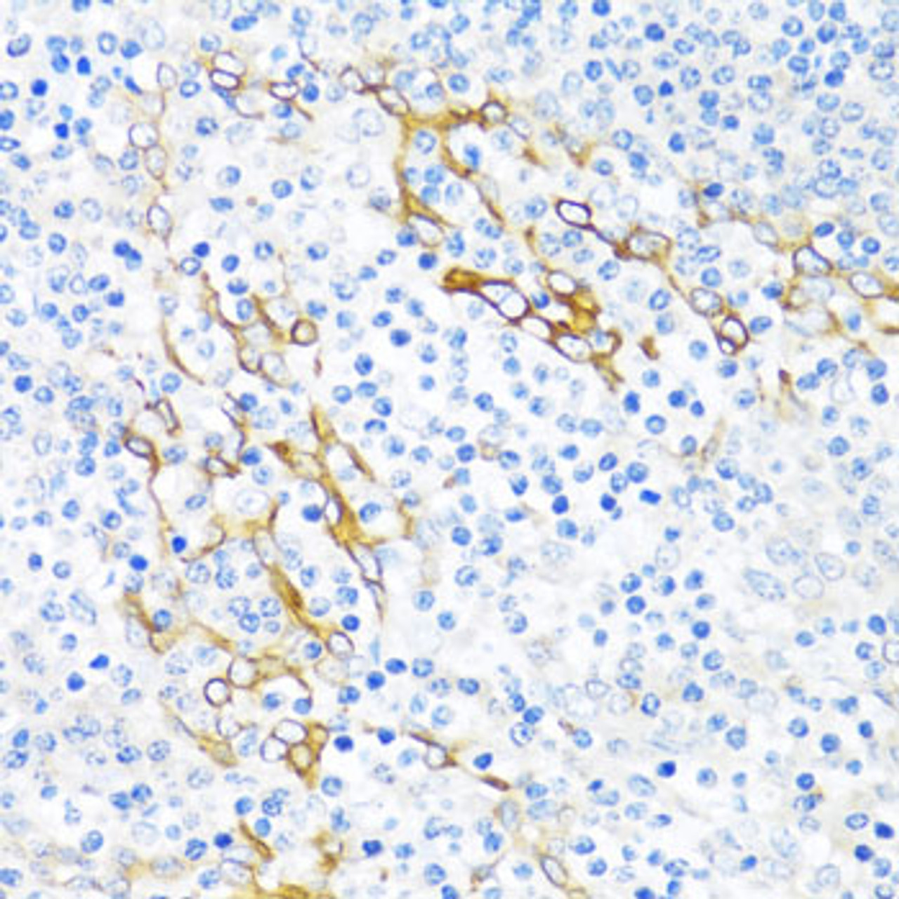 Immunohistochemistry of paraffin-embedded human tonsil using PLA2G4C antibody (23-158) at dilution of 1:100 (40x lens) .