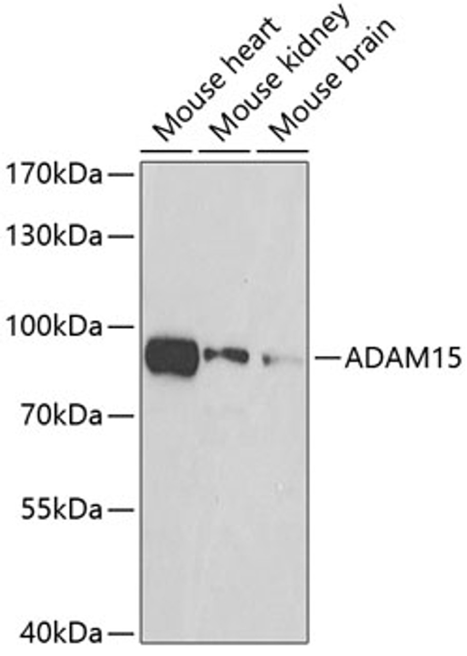 Western blot analysis of extracts of various cell lines, using ADAM15 antibody (23-160) at 1:500 dilution.<br/>Secondary antibody: HRP Goat Anti-Rabbit IgG (H+L) at 1:10000 dilution.<br/>Lysates/proteins: 25ug per lane.<br/>Blocking buffer: 3% nonfat dry milk in TBST.<br/>Detection: ECL Basic Kit.<br/>Exposure time: 90s.