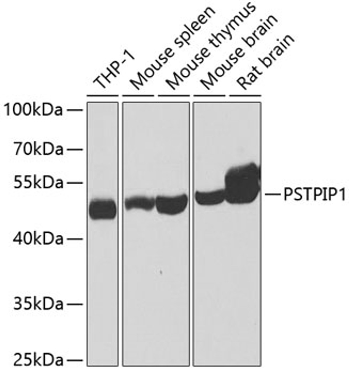 Western blot analysis of extracts of various cell lines, using PSTPIP1 antibody (23-164) at 1:1000 dilution.<br/>Secondary antibody: HRP Goat Anti-Rabbit IgG (H+L) at 1:10000 dilution.<br/>Lysates/proteins: 25ug per lane.<br/>Blocking buffer: 3% nonfat dry milk in TBST.<br/>Detection: ECL Basic Kit.<br/>Exposure time: 40s.
