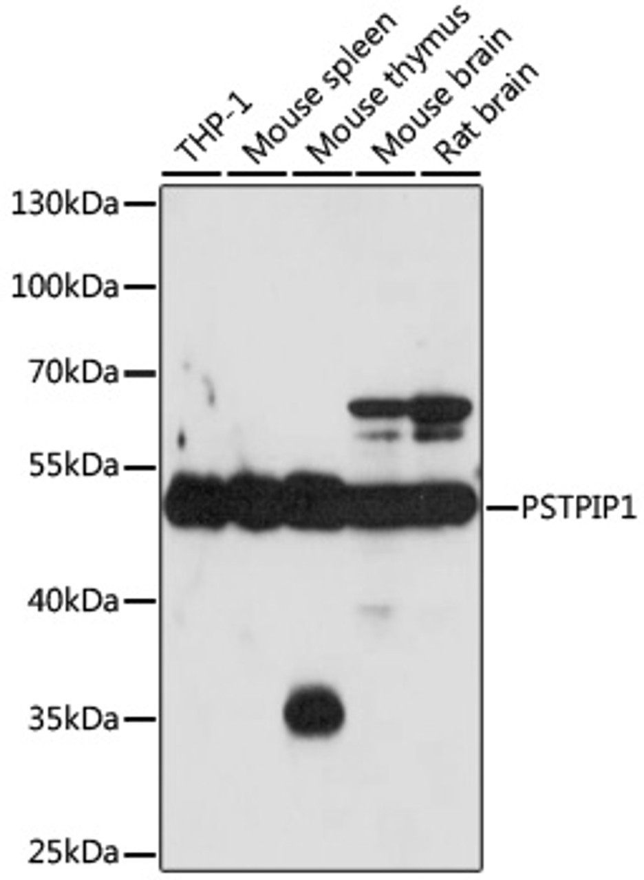 Immunohistochemistry of paraffin-embedded human stomach using PSTPIP1 antibody (23-164) at dilution of 1:100 (40x lens) .
