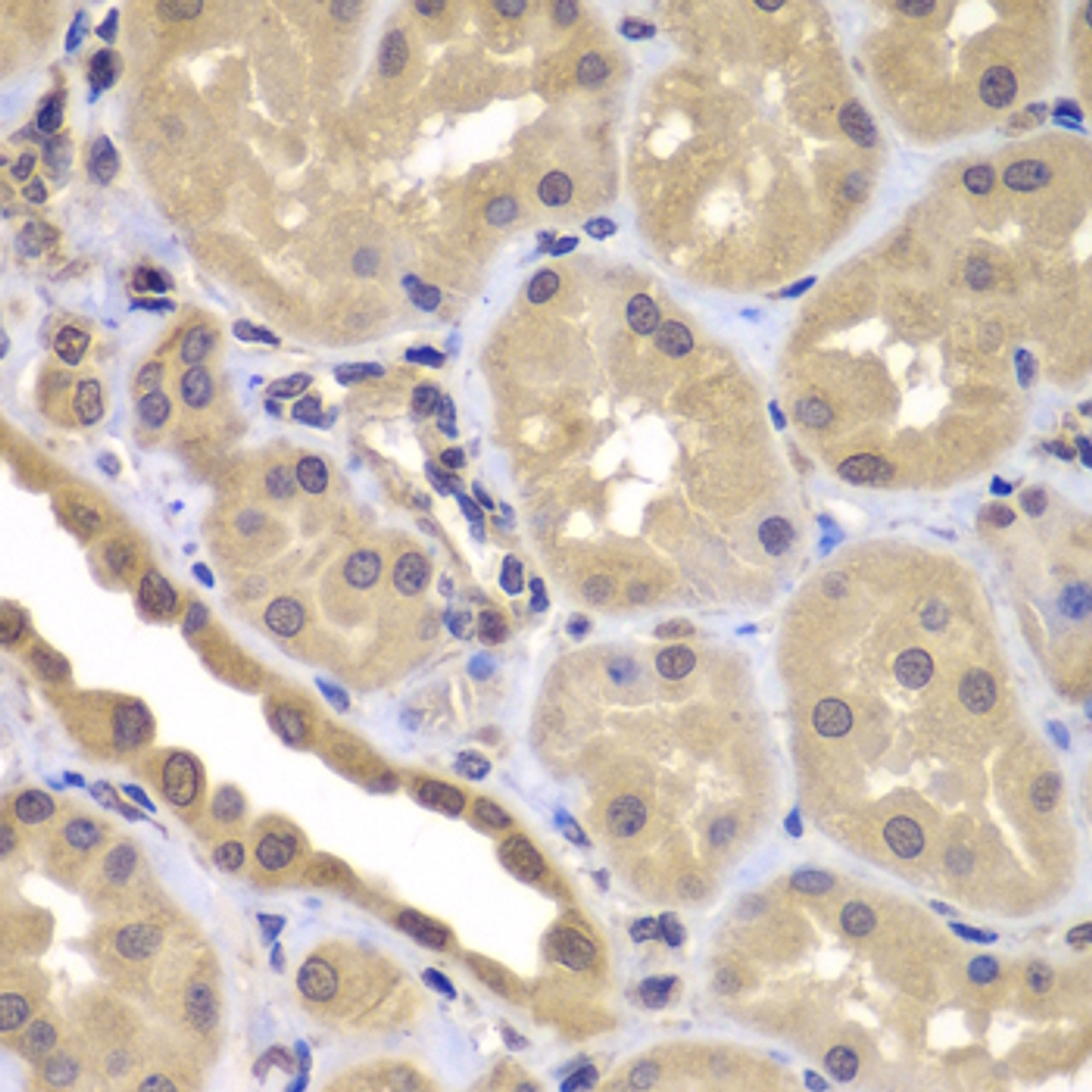 Immunohistochemistry of paraffin-embedded human kidney using BAG2 antibody (23-166) at dilution of 1:100 (40x lens) .