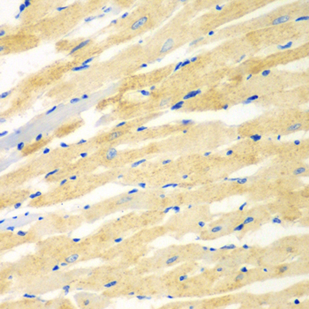 Immunohistochemistry of paraffin-embedded rat heart using PDE4DIP antibody (23-167) at dilution of 1:100 (40x lens) .