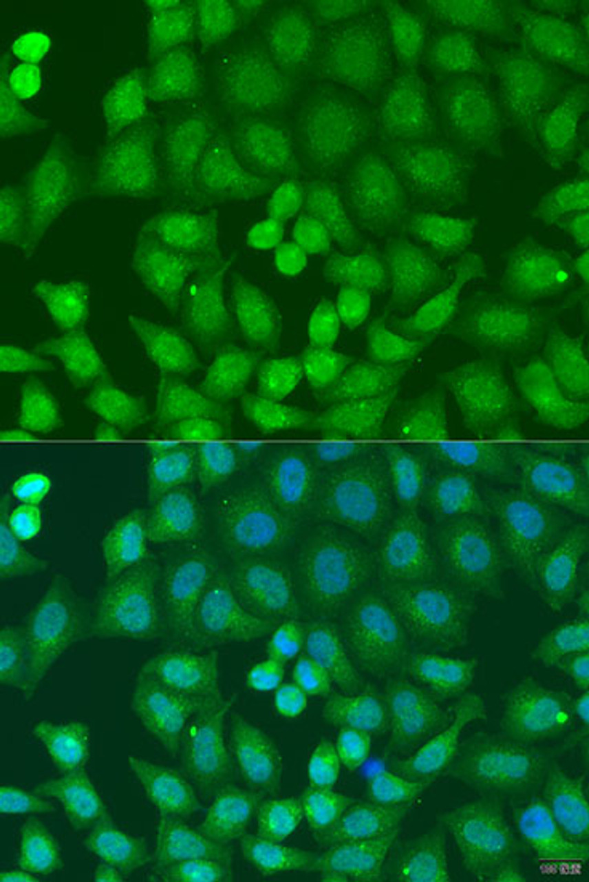 Immunofluorescence analysis of U2OS cells using ZFYVE16 antibody (23-168) at dilution of 1:100. Blue: DAPI for nuclear staining.