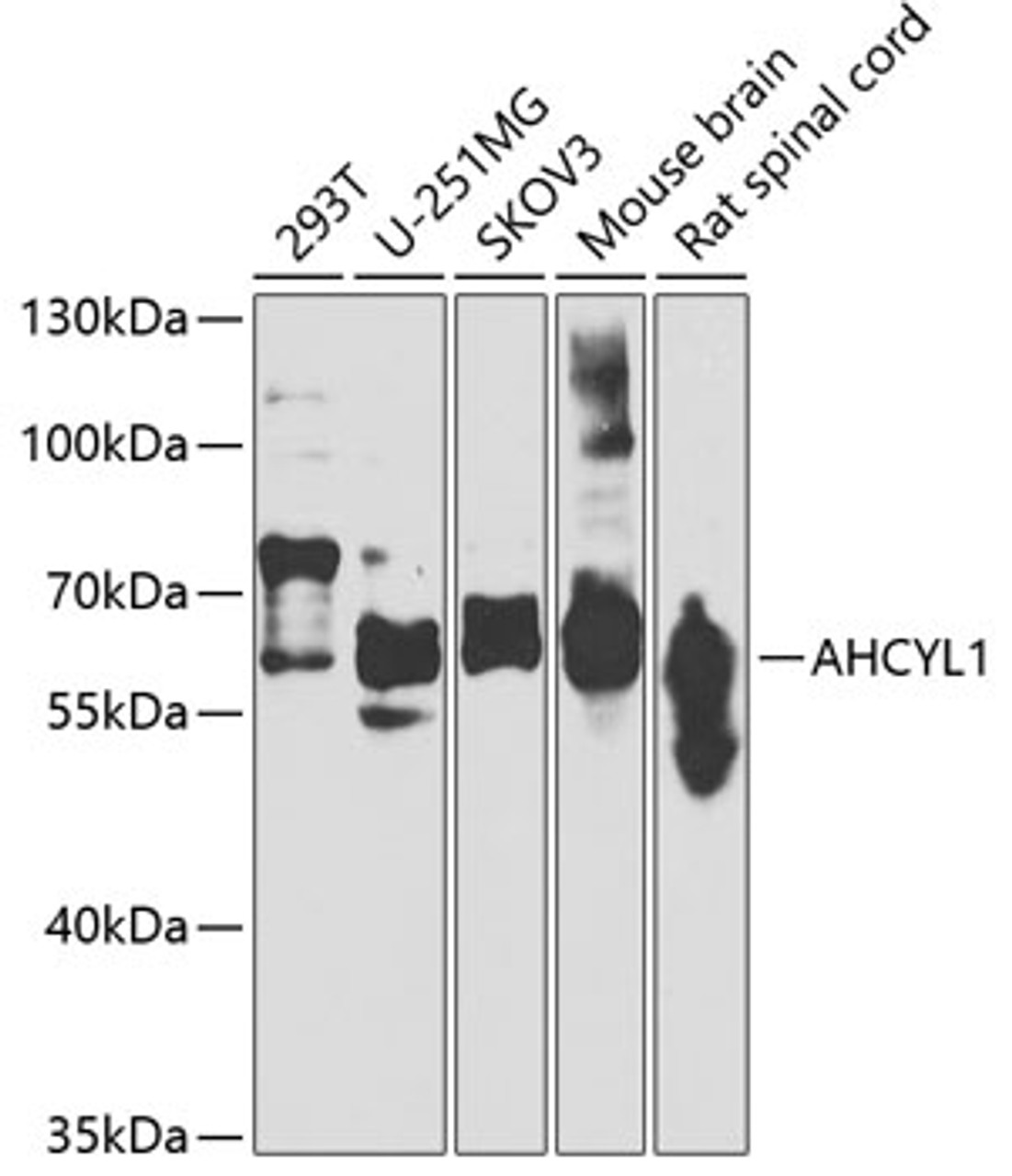 Western blot analysis of extracts of various cell lines, using AHCYL1 antibody (23-174) at 1:1000 dilution._Secondary antibody: HRP Goat Anti-Rabbit IgG (H+L) at 1:10000 dilution._Lysates/proteins: 25ug per lane._Blocking buffer: 3% nonfat dry milk in TBST._Detection: ECL Basic Kit._Exposure time: 90s.