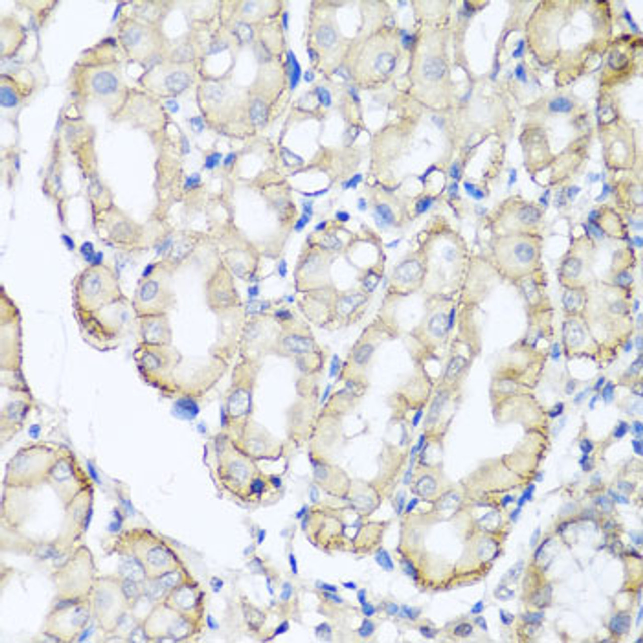 Immunohistochemistry of paraffin-embedded human stomach using AHCYL1 antibody (23-174) at dilution of 1:100 (40x lens) .