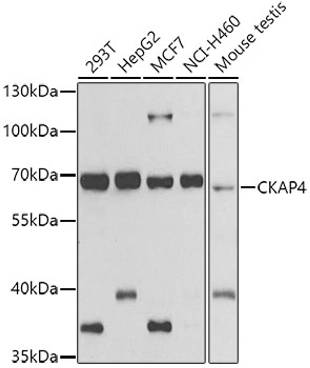 Western blot analysis of extracts of various cell lines, using CKAP4 antibody (23-178) at 1:500 dilution.<br/>Secondary antibody: HRP Goat Anti-Rabbit IgG (H+L) at 1:10000 dilution.<br/>Lysates/proteins: 25ug per lane.<br/>Blocking buffer: 3% nonfat dry milk in TBST.<br/>Detection: ECL Basic Kit.<br/>Exposure time: 90s.
