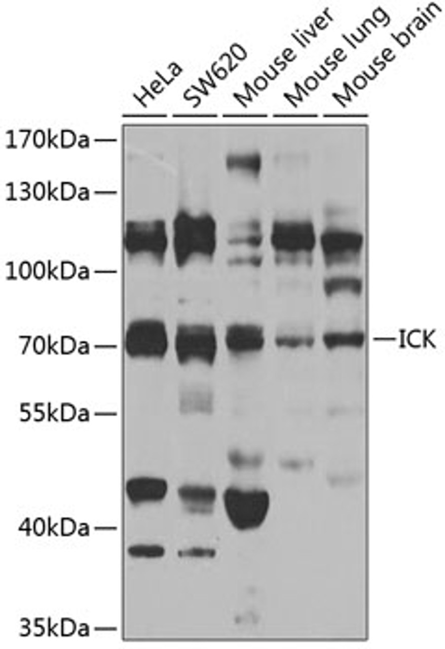 Western blot analysis of extracts of various cell lines, using ICK antibody (23-180) at 1:1000 dilution.<br/>Secondary antibody: HRP Goat Anti-Rabbit IgG (H+L) at 1:10000 dilution.<br/>Lysates/proteins: 25ug per lane.<br/>Blocking buffer: 3% nonfat dry milk in TBST.<br/>Detection: ECL Basic Kit.<br/>Exposure time: 30s.