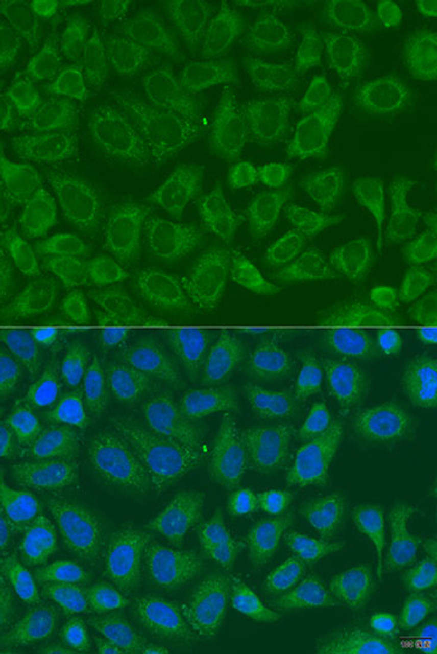 Immunofluorescence analysis of U2OS cells using ICK antibody (23-180) at dilution of 1:100. Blue: DAPI for nuclear staining.
