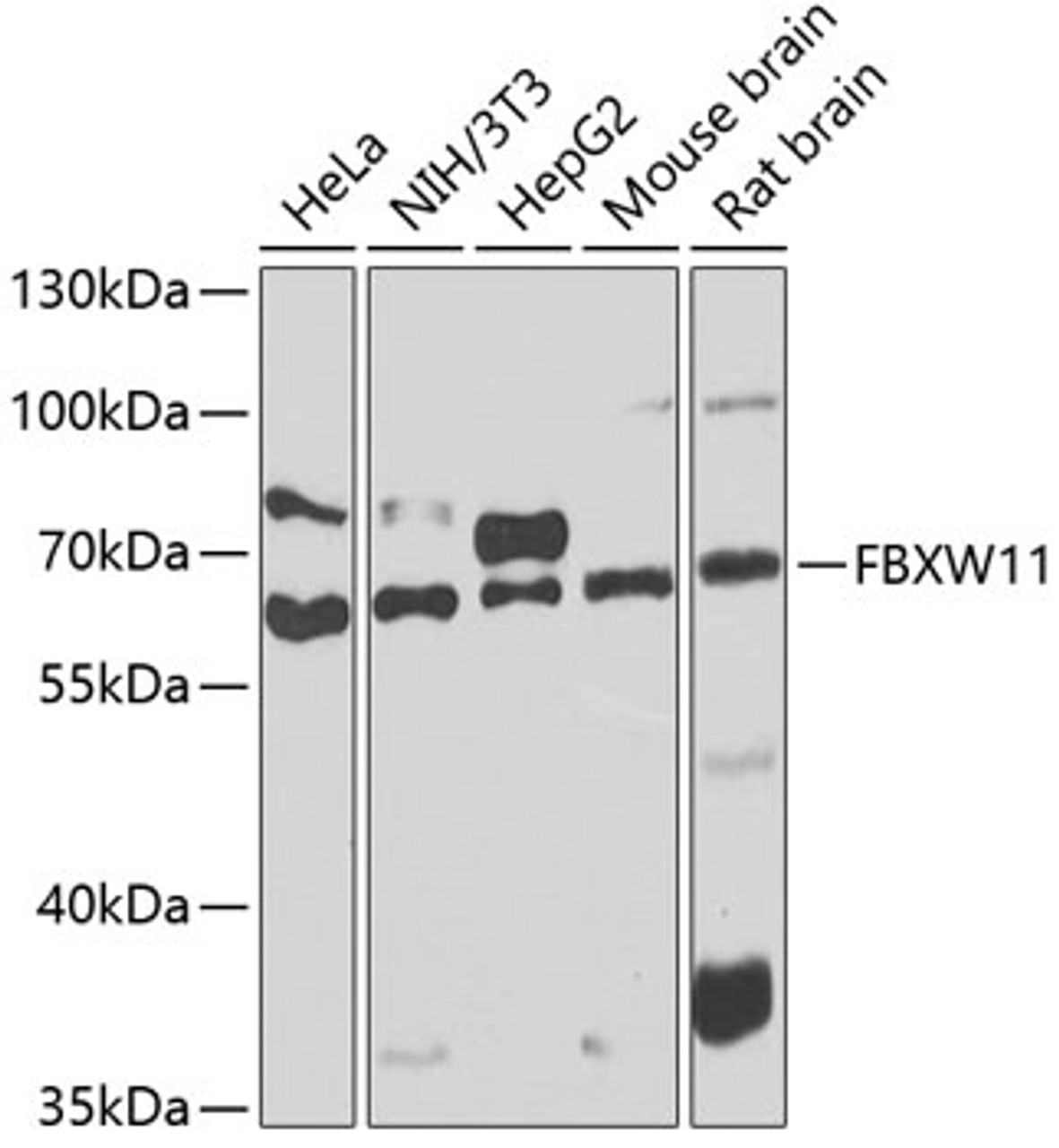 Western blot analysis of extracts of various cell lines, using FBXW11 antibody (23-181) at 1:1000 dilution.<br/>Secondary antibody: HRP Goat Anti-Rabbit IgG (H+L) at 1:10000 dilution.<br/>Lysates/proteins: 25ug per lane.<br/>Blocking buffer: 3% nonfat dry milk in TBST.<br/>Detection: ECL Basic Kit.<br/>Exposure time: 90s.