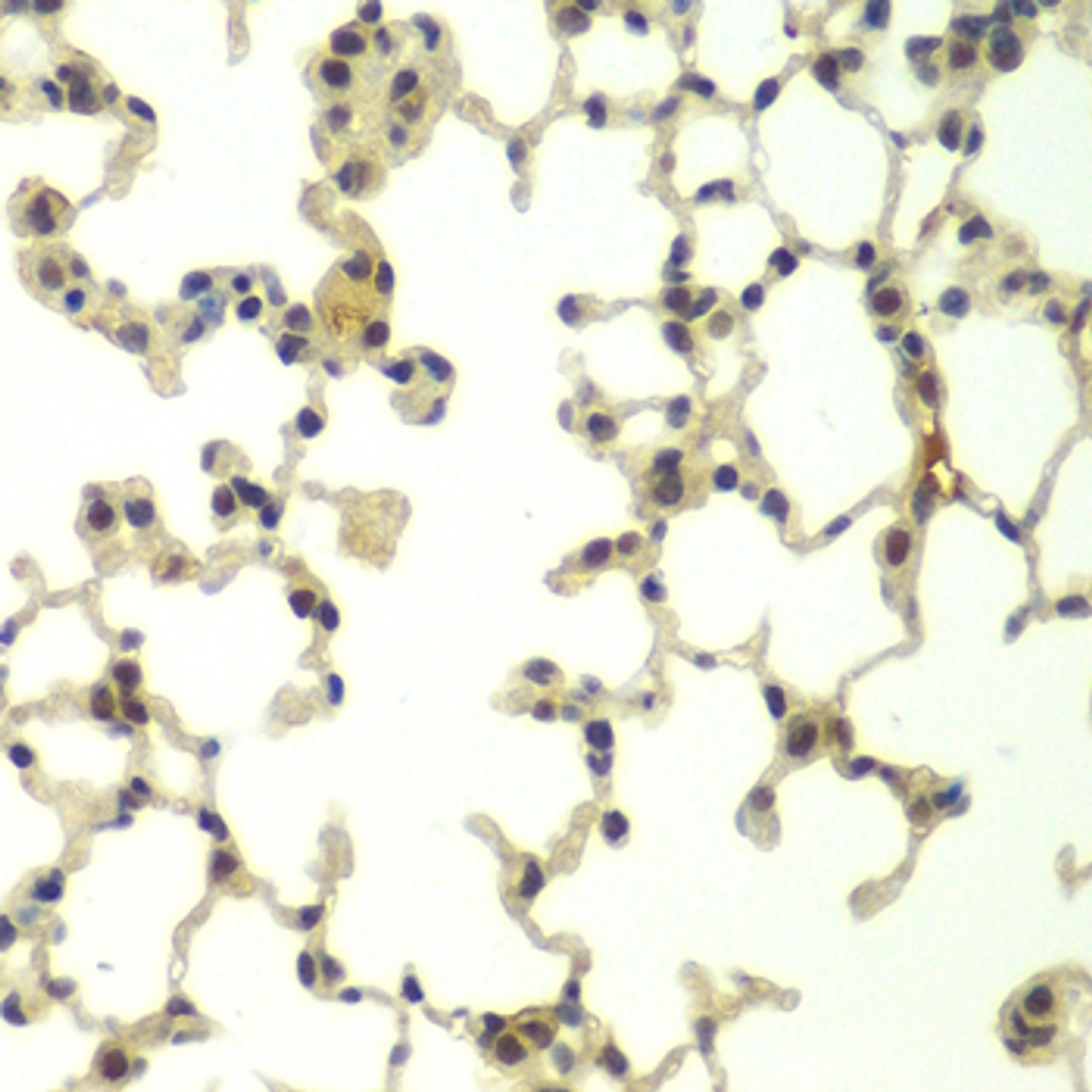 Immunohistochemistry of paraffin-embedded mouse lung using FBXW11 antibody (23-181) at dilution of 1:100 (40x lens) .