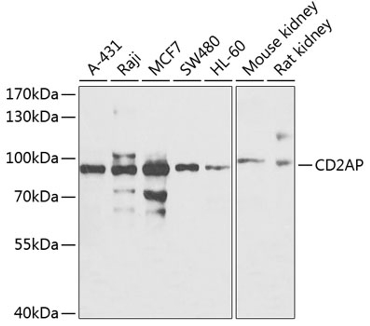 Western blot analysis of extracts of various cell lines, using CD2AP antibody (23-184) at 1:500 dilution._Secondary antibody: HRP Goat Anti-Rabbit IgG (H+L) at 1:10000 dilution._Lysates/proteins: 25ug per lane._Blocking buffer: 3% nonfat dry milk in TBST._Detection: ECL Enhanced Kit._Exposure time: 60s.