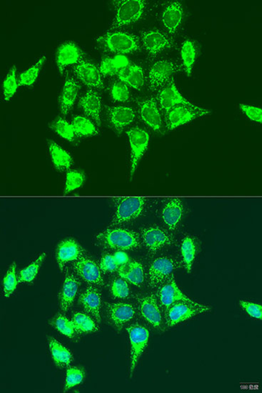 Immunofluorescence analysis of U2OS cells using RASGRP3 antibody (23-186) at dilution of 1:100. Blue: DAPI for nuclear staining.