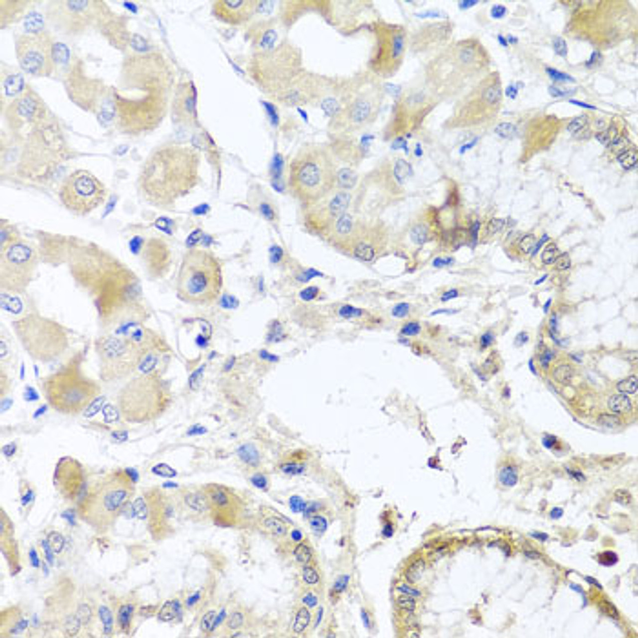Immunohistochemistry of paraffin-embedded human stomach using RPL36 antibody (23-188) at dilution of 1:100 (40x lens) .