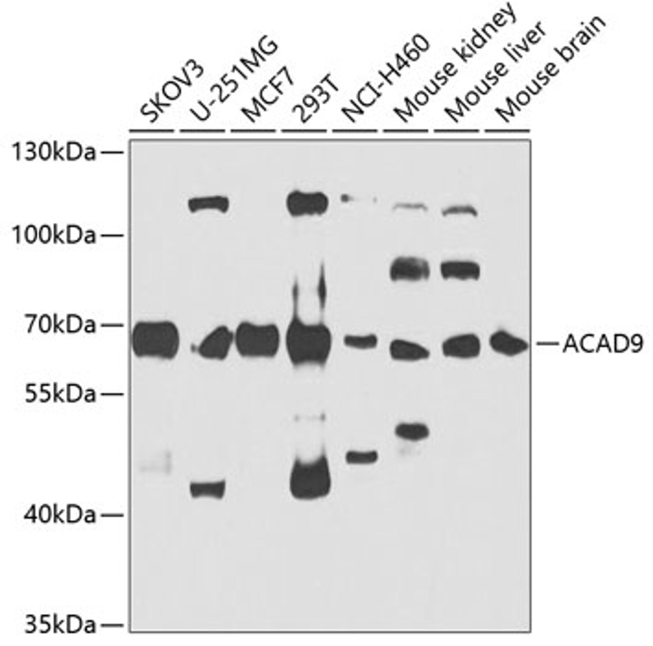 Western blot analysis of extracts of various cell lines, using ACAD9 antibody (23-191) at 1:1000 dilution.<br/>Secondary antibody: HRP Goat Anti-Rabbit IgG (H+L) at 1:10000 dilution.<br/>Lysates/proteins: 25ug per lane.<br/>Blocking buffer: 3% nonfat dry milk in TBST.<br/>Detection: ECL Basic Kit.<br/>Exposure time: 90s.