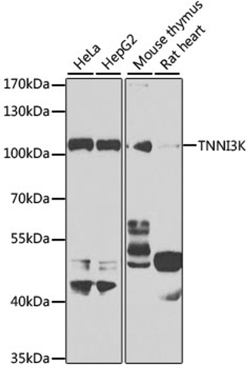 Western blot analysis of extracts of various cell lines, using TNNI3K antibody (23-193) at 1:1000 dilution.<br/>Secondary antibody: HRP Goat Anti-Rabbit IgG (H+L) at 1:10000 dilution.<br/>Lysates/proteins: 25ug per lane.<br/>Blocking buffer: 3% nonfat dry milk in TBST.<br/>Detection: ECL Basic Kit.<br/>Exposure time: 90s.