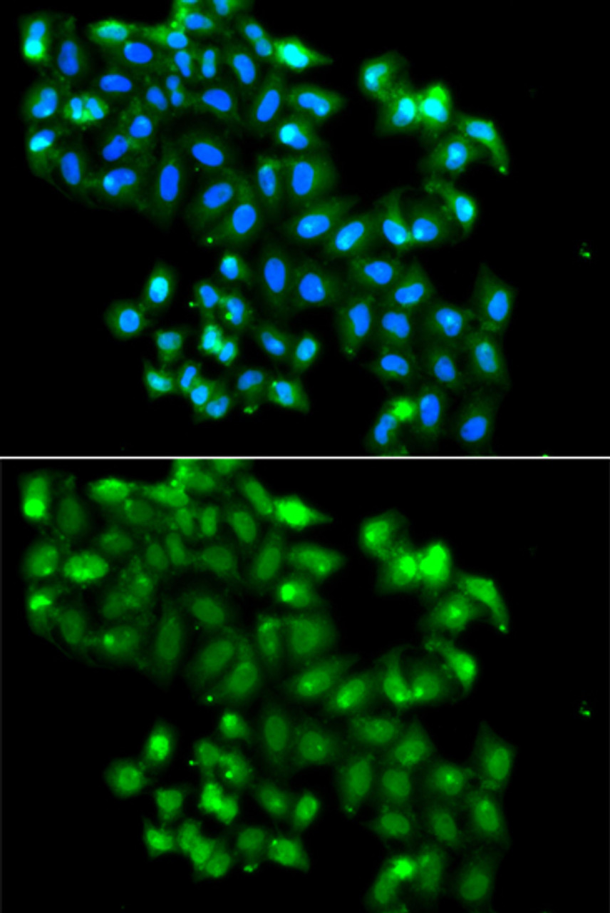 Immunofluorescence analysis of A549 cells using PHF11 antibody (23-194) . Blue: DAPI for nuclear staining.