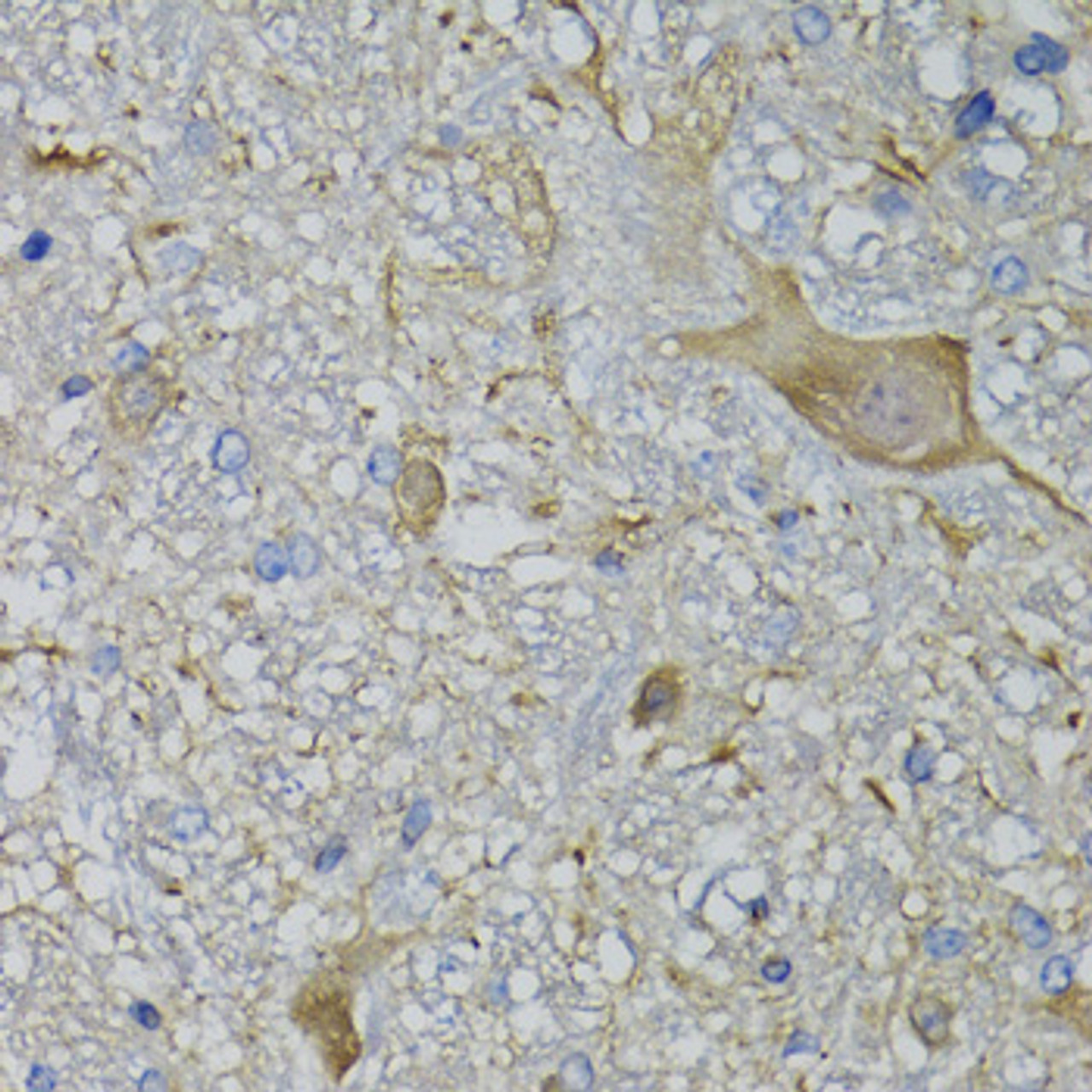 Immunohistochemistry of paraffin-embedded mouse brain using CALML5 antibody (23-197) at dilution of 1:100 (40x lens) .