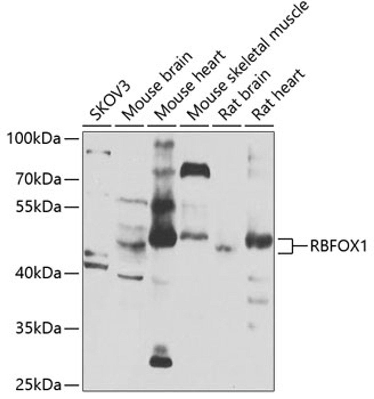 Western blot analysis of extracts of various cell lines, using RBFOX1 antibody (23-200) at 1:1000 dilution.<br/>Secondary antibody: HRP Goat Anti-Rabbit IgG (H+L) at 1:10000 dilution.<br/>Lysates/proteins: 25ug per lane.<br/>Blocking buffer: 3% nonfat dry milk in TBST.<br/>Detection: ECL Basic Kit.<br/>Exposure time: 5s.