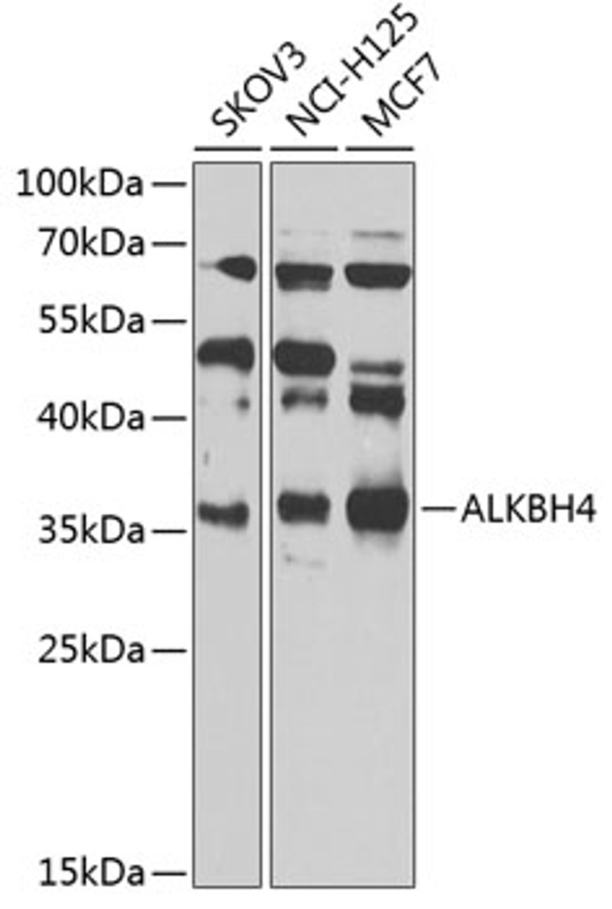 Western blot analysis of extracts of various cell lines, using ALKBH4 Antibody (23-201) at 1:1000 dilution.<br/>Secondary antibody: HRP Goat Anti-Rabbit IgG (H+L) at 1:10000 dilution.<br/>Lysates/proteins: 25ug per lane.<br/>Blocking buffer: 3% nonfat dry milk in TBST.<br/>Detection: ECL Basic Kit.<br/>Exposure time: 10s.