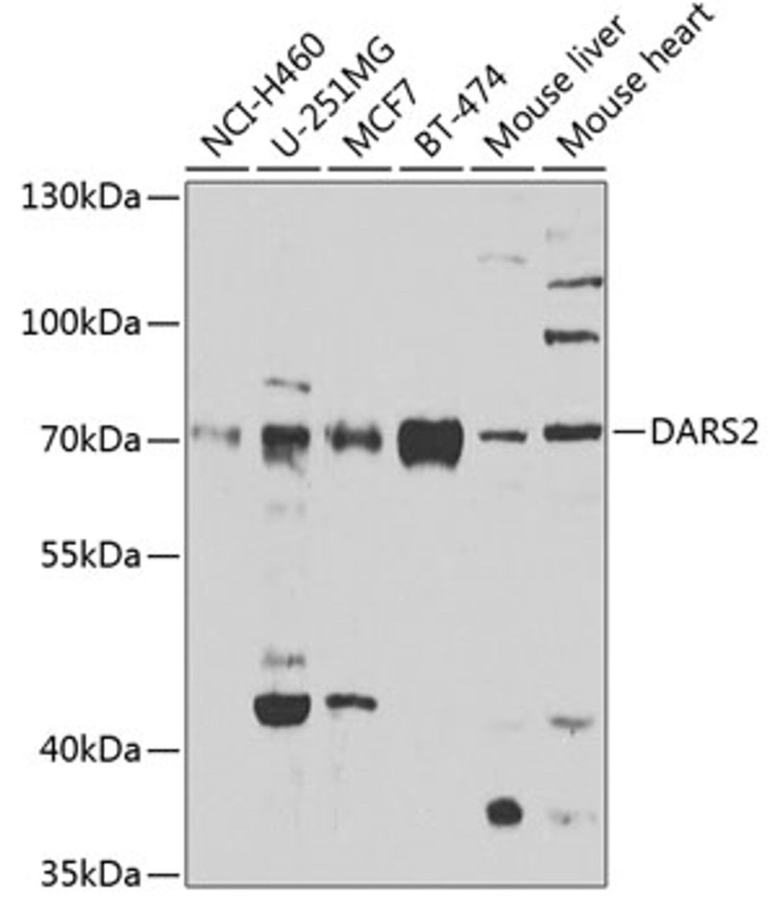 Western blot analysis of extracts of various cell lines, using DARS2 antibody (23-202) at 1:1000 dilution.<br/>Secondary antibody: HRP Goat Anti-Rabbit IgG (H+L) at 1:10000 dilution.<br/>Lysates/proteins: 25ug per lane.<br/>Blocking buffer: 3% nonfat dry milk in TBST.<br/>Detection: ECL Enhanced Kit.<br/>Exposure time: 90s.