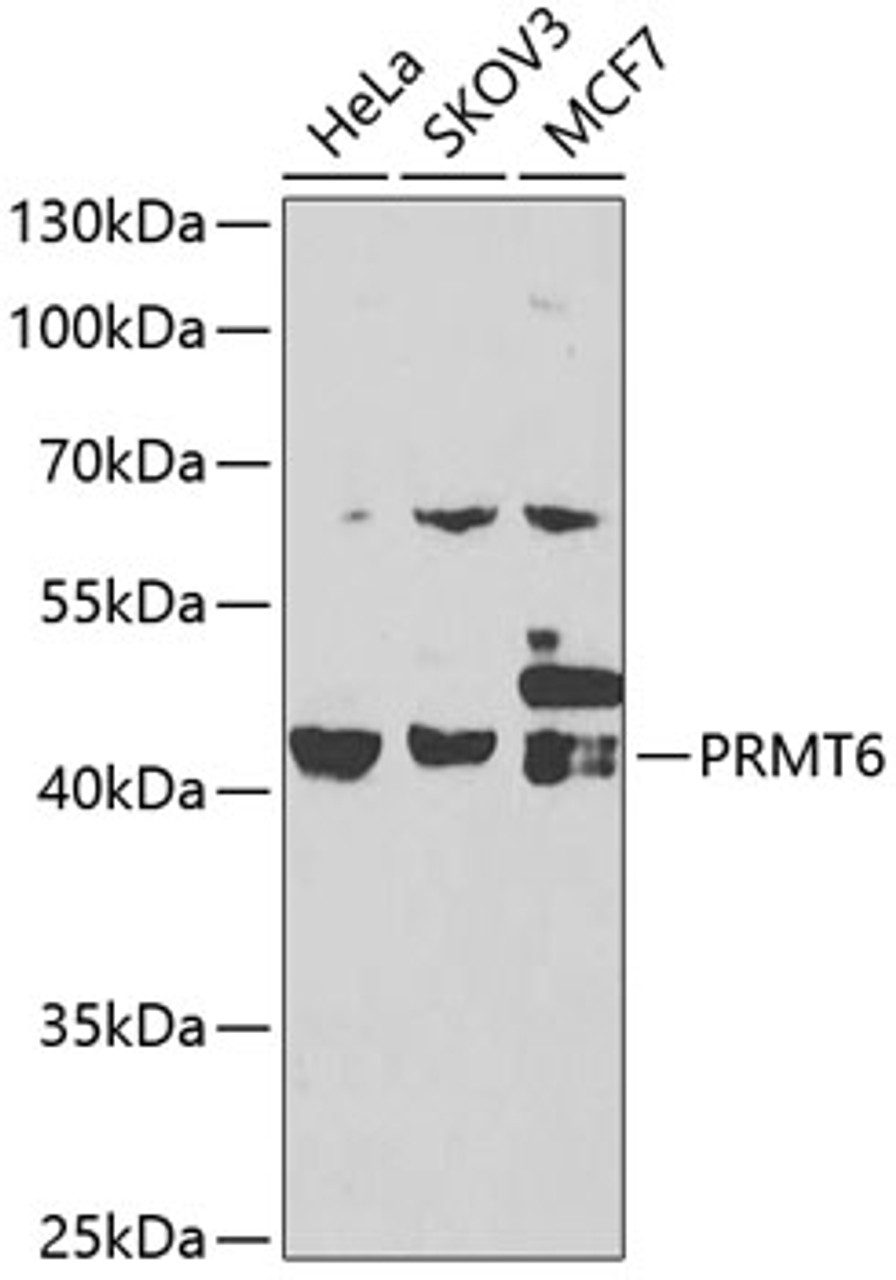 Western blot analysis of extracts of various cell lines, using PRMT6 antibody (23-203) at 1:1000 dilution.<br/>Secondary antibody: HRP Goat Anti-Rabbit IgG (H+L) at 1:10000 dilution.<br/>Lysates/proteins: 25ug per lane.<br/>Blocking buffer: 3% nonfat dry milk in TBST.<br/>Detection: ECL Basic Kit.<br/>Exposure time: 90s.