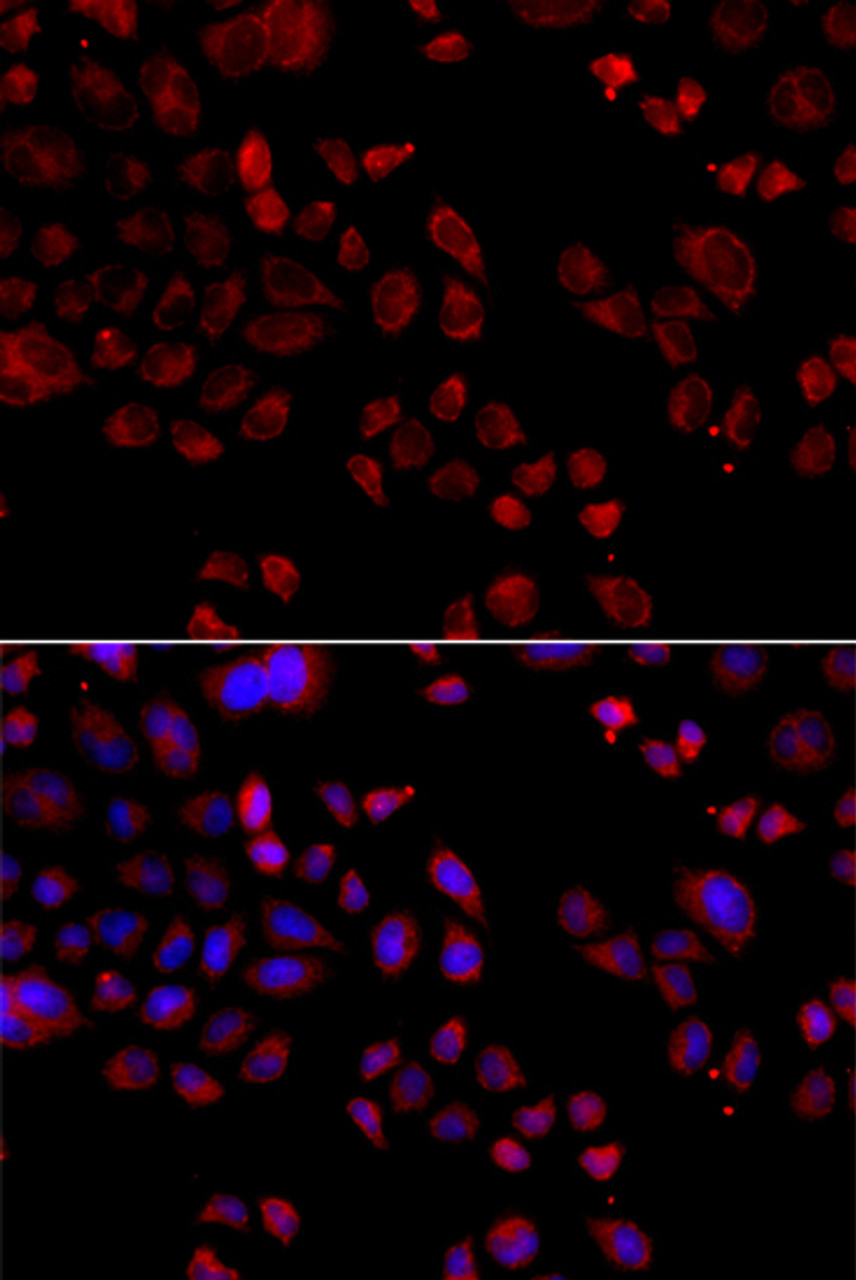 Immunofluorescence analysis of A549 cells using SLC22A11 antibody (23-204) . Blue: DAPI for nuclear staining.